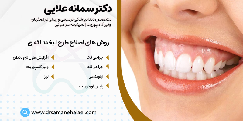 روش های اصلاح لبخند لثه ای در اصفهان