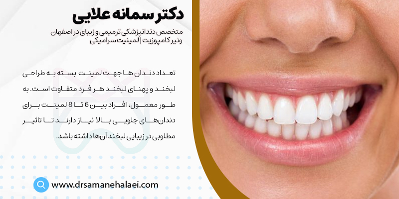 تاثیرگذاری تعداد دندان ها در قیمت نهایی لمینت دندان در اصفهان