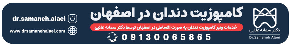 کامپوزیت دندان در اصفهان