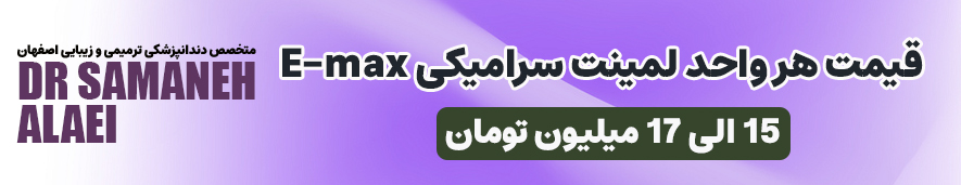 قیمت لمینت سرامیکی در سال 1405