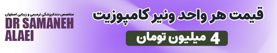 قیمت ونیر کامپوزیت در اصفهان 