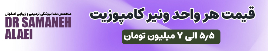 قیمت لمینت دندان در سال 1404