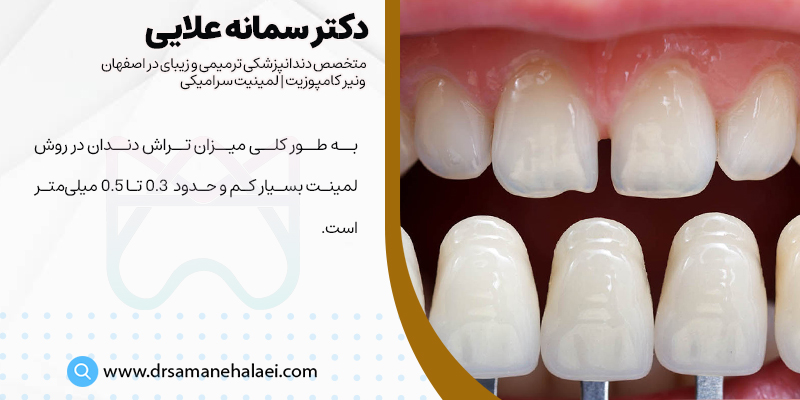 تراش کمتر دندان در روش لمینت دندان