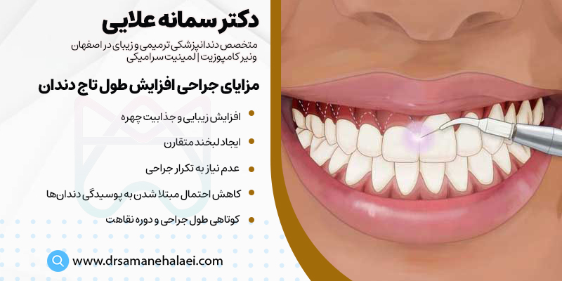 مزایای جراحی افزایش طول تاج دندان