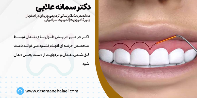 عوارض جراحی افزایش طول تاج دندان