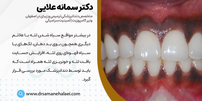 علائم همراه با سیاه شدن لثه