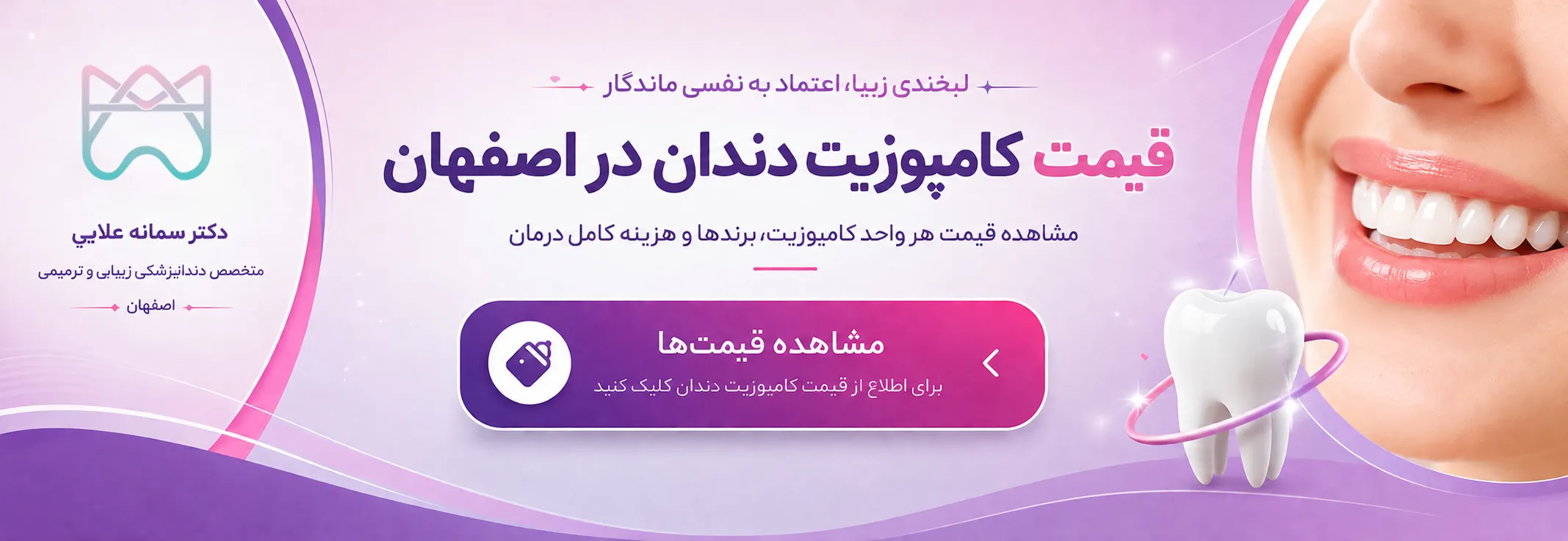 قیمت کامپوزیت دندان در اصفهان