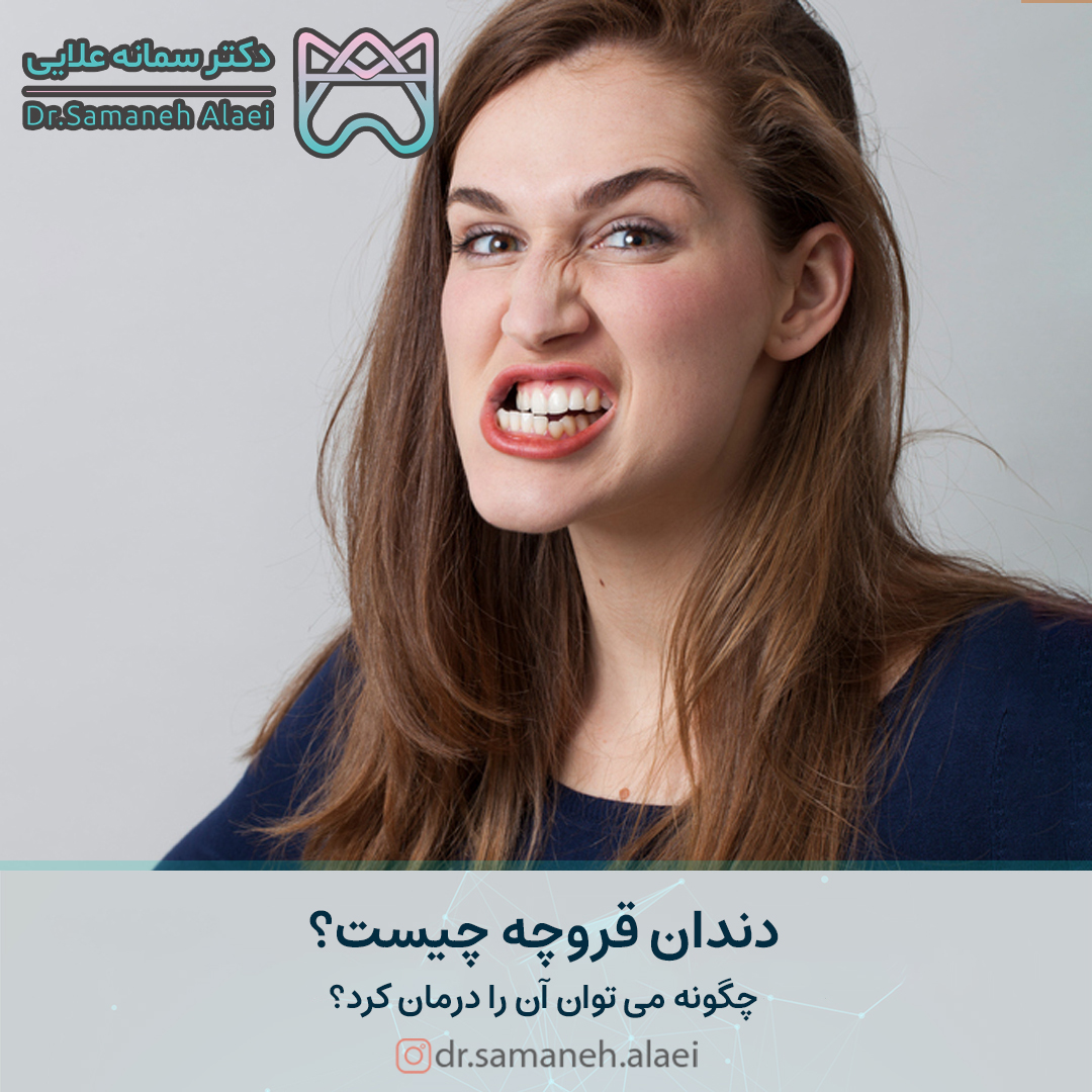 دندان قروچه چیست و چگونه می‌توان آن را درمان کرد؟