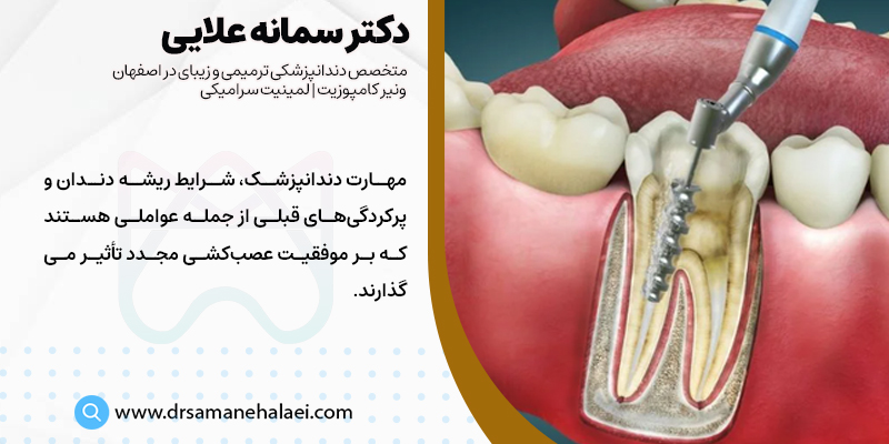 شرایط موفقیت عصب کشی مجدد دندان