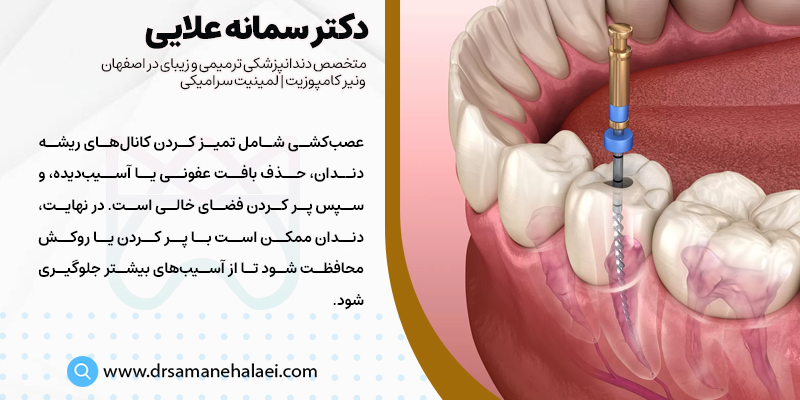 عصب کشی دندان چیست؟