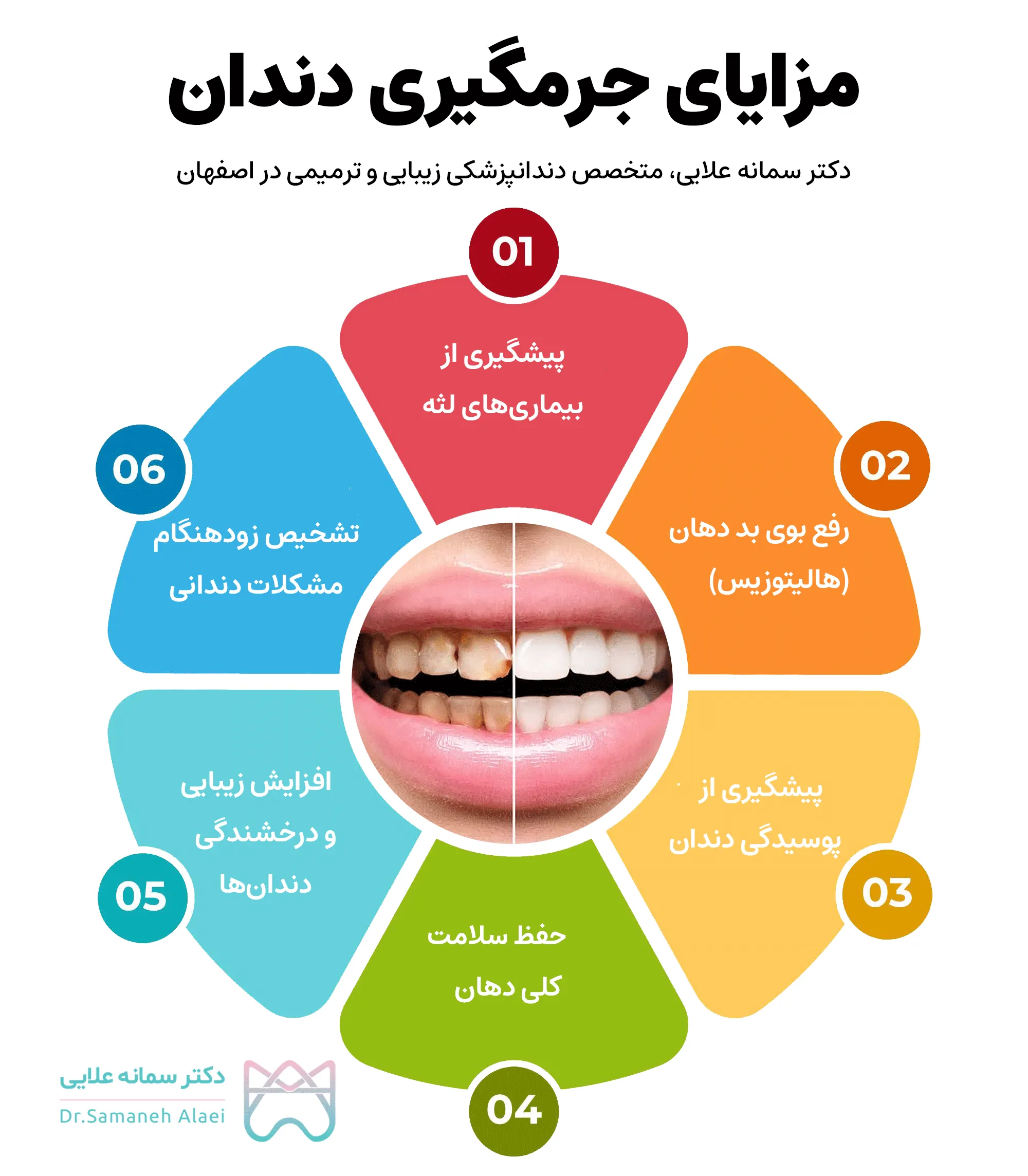 اینفوگرافیک مزایای جرمگیری دندان