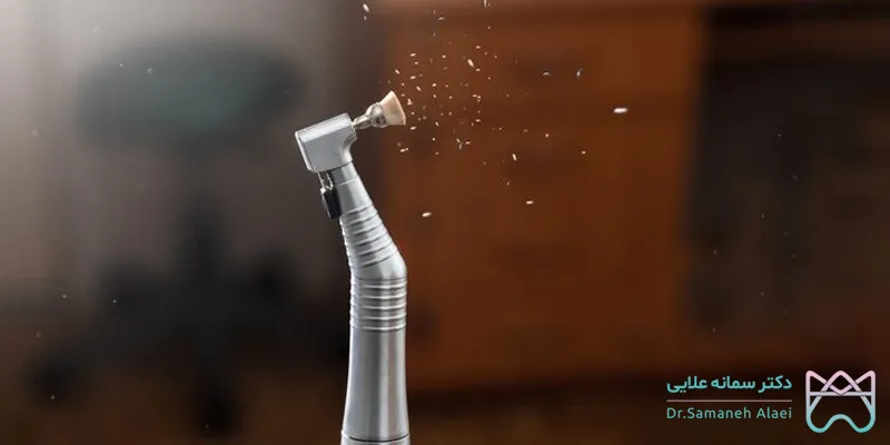 جرمگیری دندان در اصفهان