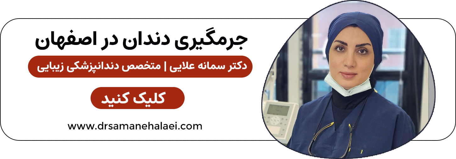 جرمگیری دندان در اصفهان