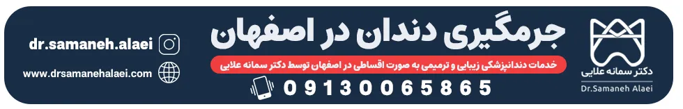 جرمگیری دندان در اصفهان