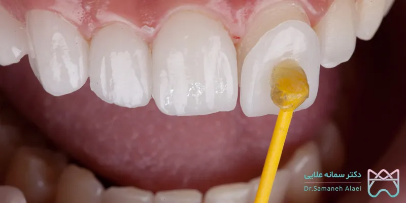 کامپوزیت برند سوئیسی