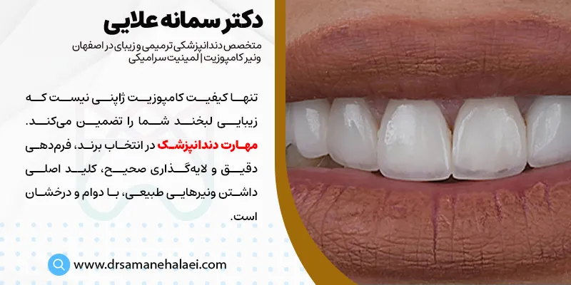 معرفی انواع کامپوزیت دندان ساخت کشور ژاپن+ قیمت