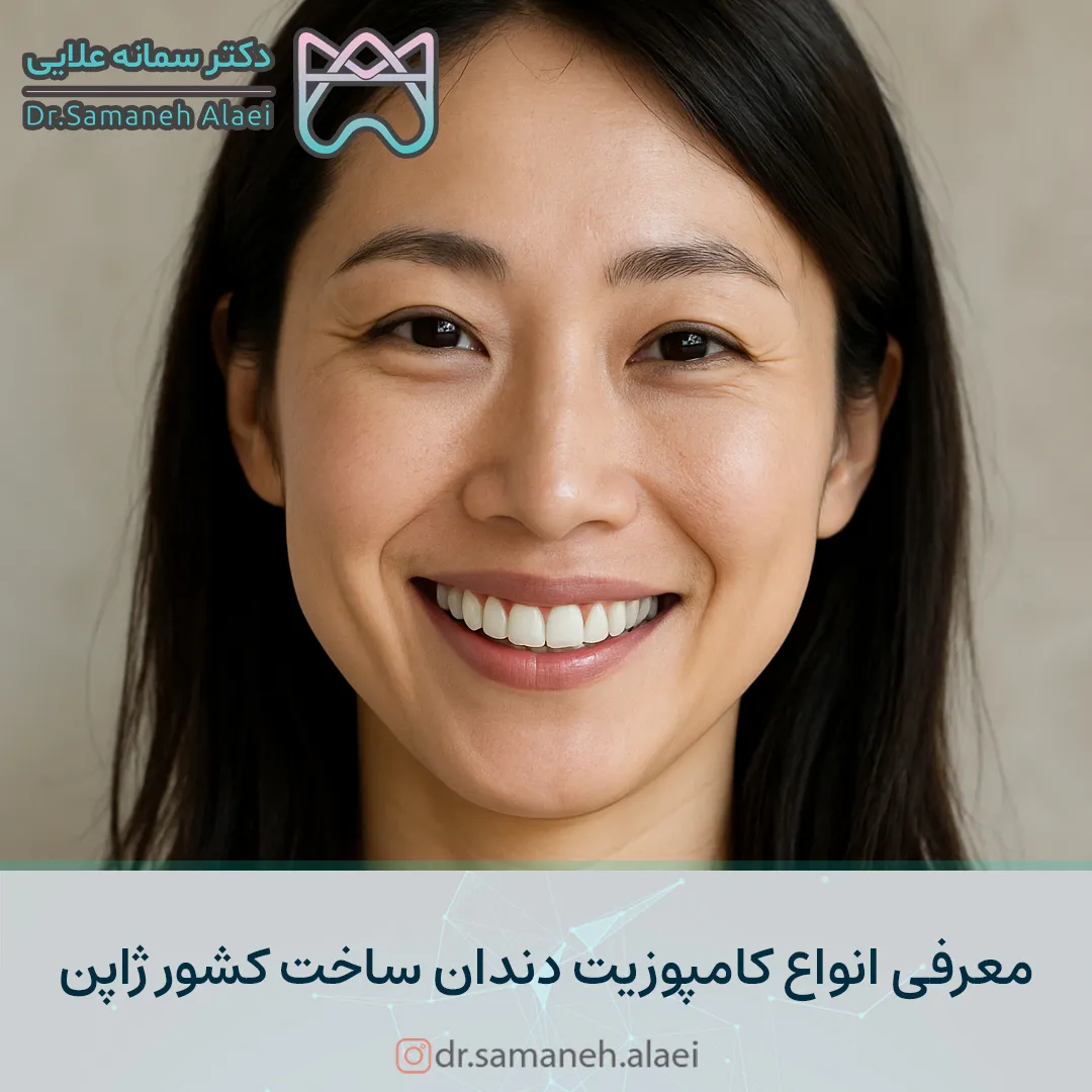 معرفی انواع کامپوزیت دندان ساخت کشور ژاپن+ قیمت