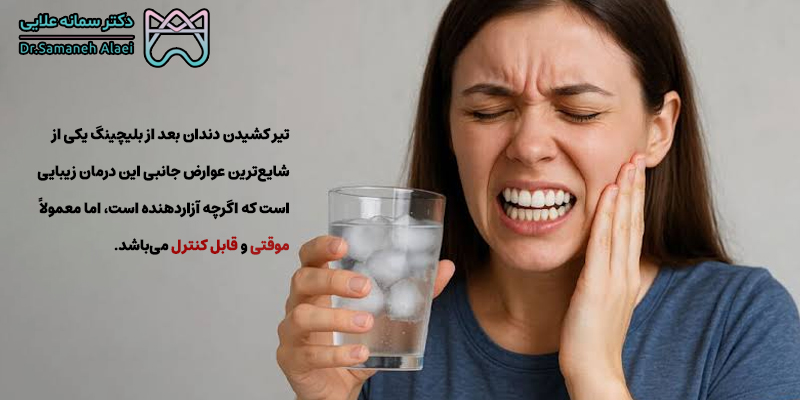 تیر کشیدن دندان بعد از بلیچینگ دندان