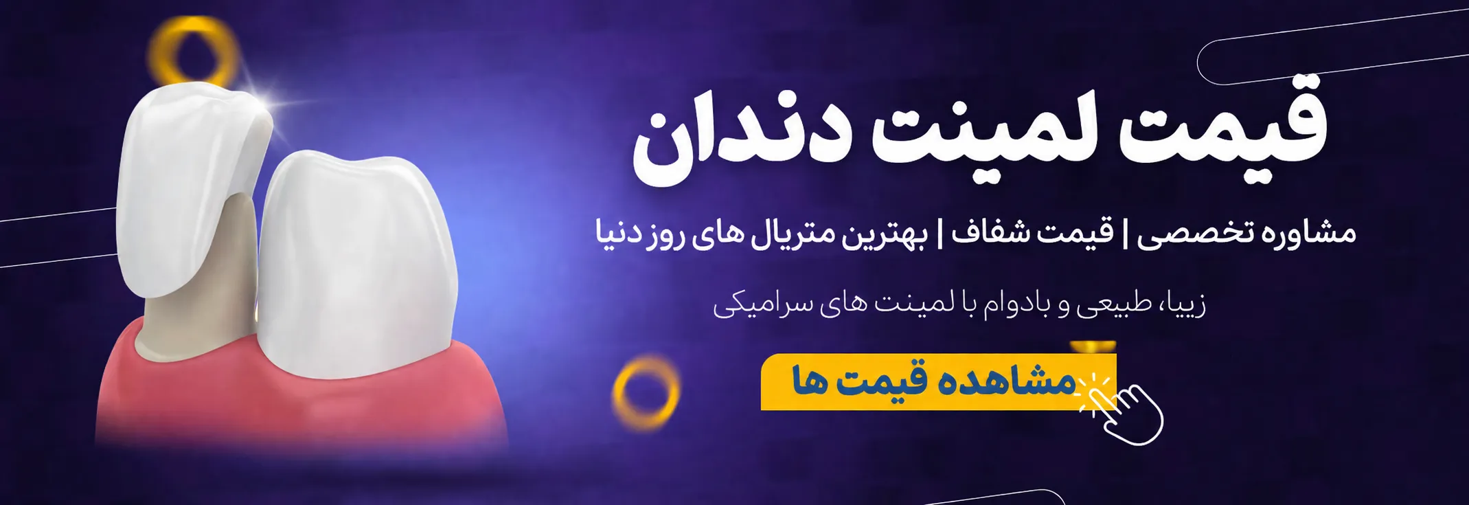 قیمت لمینت دندان