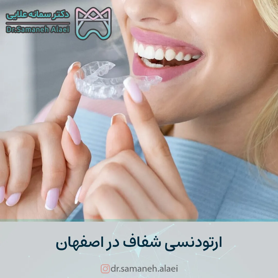 ارتودنسی شفاف در اصفهان