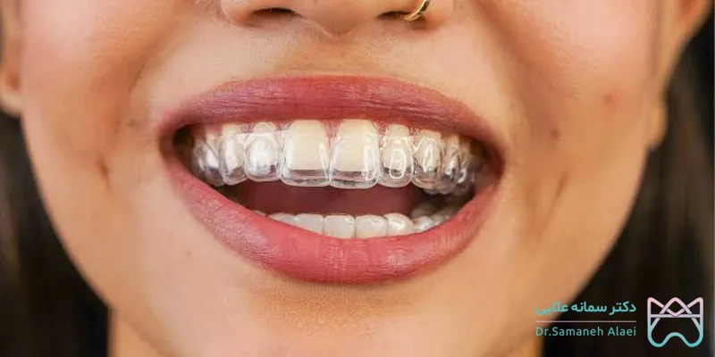الاینر شفاف چیست؟