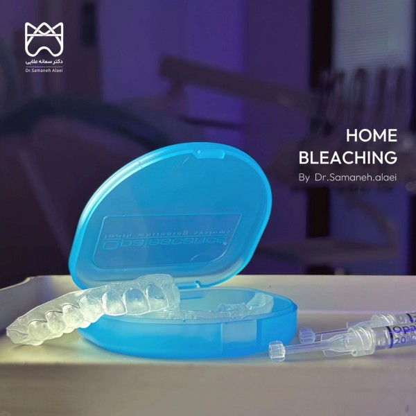 سفید کردن دندان در اصفهان