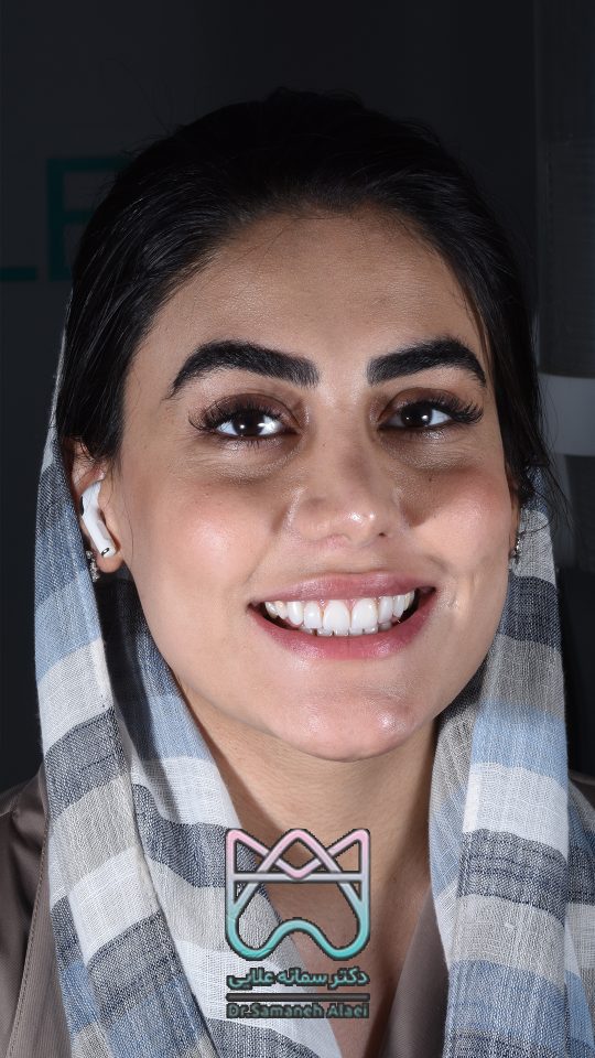 متخصص دندانپزشکی زیبایی در اصفهان دکتر سمانه علایی