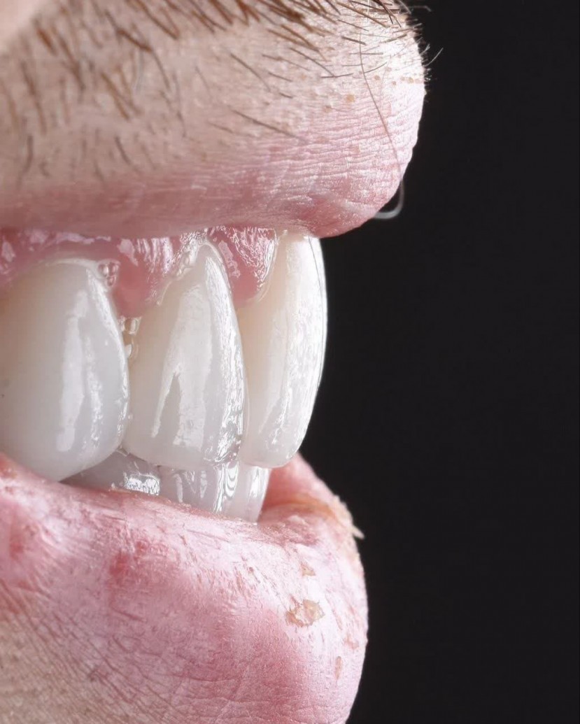 لمینیت سرامیکی در اصفهان