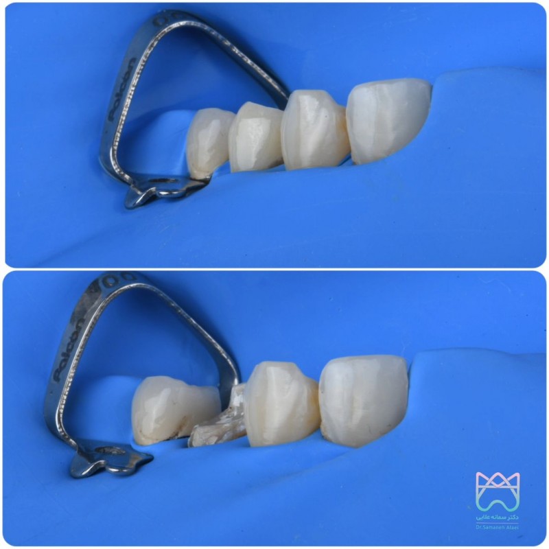 درمان ترمیمی در اصفهان
