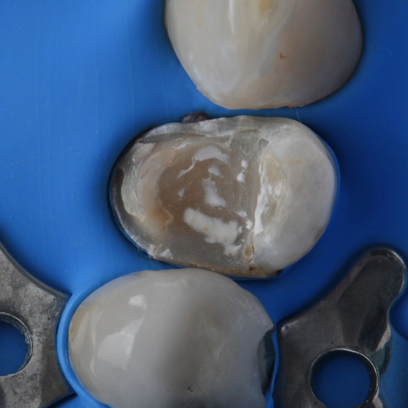 درمان ترمیمی در اصفهان