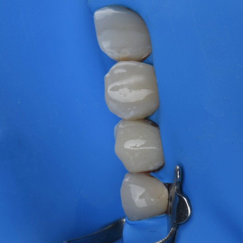 درمان ترمیمی در اصفهان